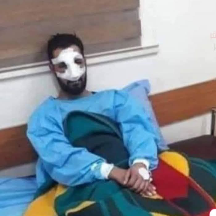 واقعة صادمة قبل العيد.. سيدة تقطع أنف زوجها بسبب كحك العيد والخلاف على المصاريف